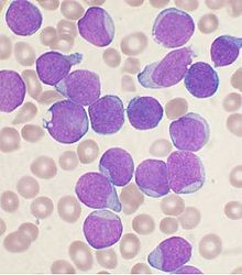 Imatge relacionada amb hematologia