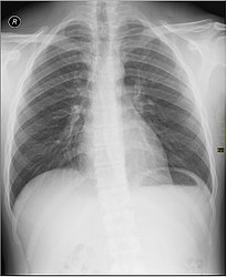 Imatge relacionada amb radiologia