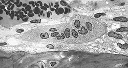 Imatge relacionada amb osteoclast