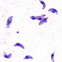 Imatge relacionada amb toxoplasmosi